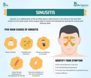 What is Sinus Infection When to See a Doctor? - Natural Way Stop Anxiety